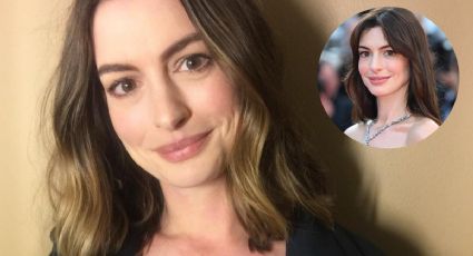 Anne Hathaway usa este truco para no tener arrugas en los ojos y lucir joven