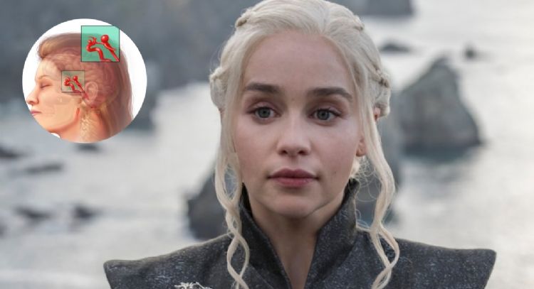 ¿Qué es una aneurisma y que la provocó a Emilia Clarke de 'Game of Thrones'?