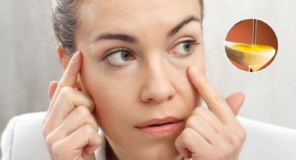 ¿Cuál es el mejor aceite para eliminar las ojeras?