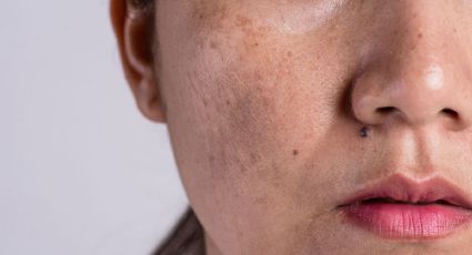 ¿Cómo hidratar la piel seca de la cara? Prueba estos trucos caseros