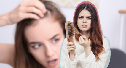 Cómo usar minoxidil en el cabello para combatir la caída y alopecia