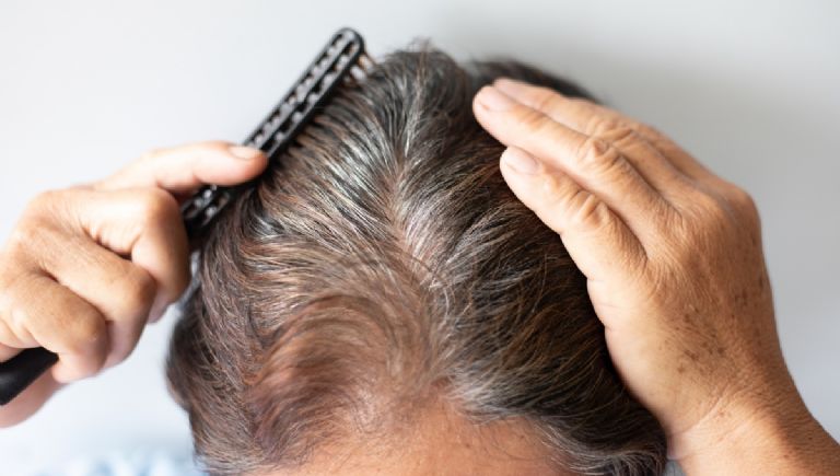 El cabello envejece con el tiempo y se cae más, pierde fuerza y brillo