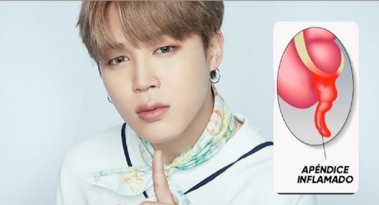 Apendicitis aguda, la enfermedad que sufrió Jimin de BTS y que debes atender a tiempo