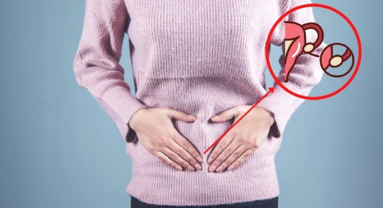 Síntomas de que puedes tener síndrome de ovario poliquístico