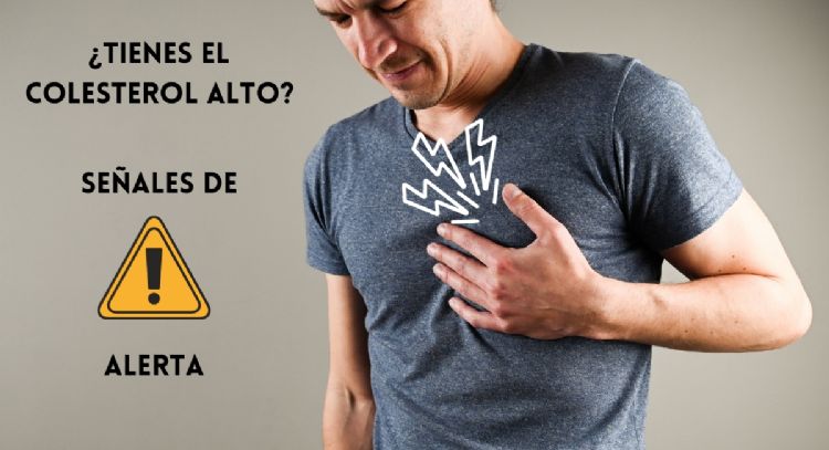 Signos que presenta tu cuerpo cuando tienes colesterol ALTO
