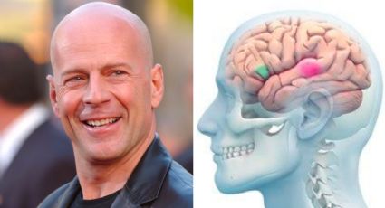 ¿Qué es afasia? La enfermedad por la que Bruce Willis se retira de la actuación