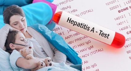 Hepatitis aguda infantil: ¿cuáles son los síntomas y cómo prevenir la enfermedad en niños?