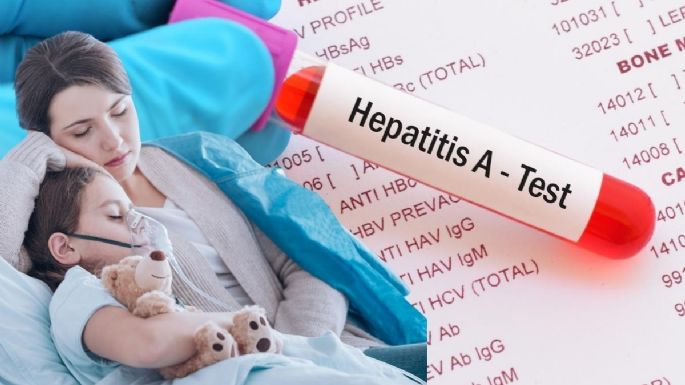 Hepatitis aguda infantil: ¿cuáles son los síntomas y cómo prevenir la enfermedad en niños?