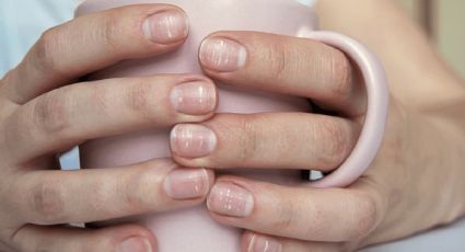 ¿Por qué salen manchas blancas en las uñas?
