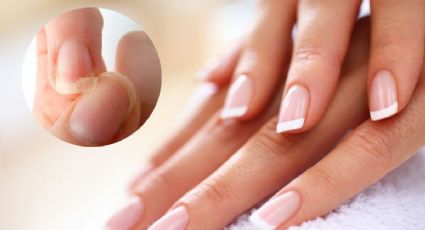3 errores que debilitan el crecimiento de tus uñas y tips para remediarlo
