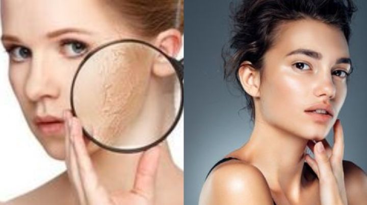 ¿Cómo saber si tu piel es seca o grasa?