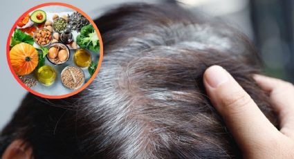 Canas en el cabello: vitaminas y alimentos que debes consumir para evitarlas