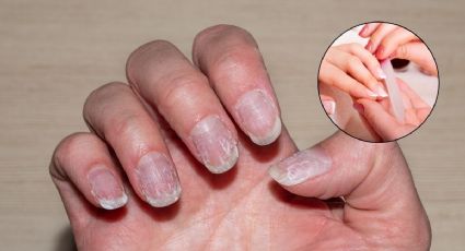 ¿Tienes las uñas secas? 3 formas de hidratarlas para que no se rompan