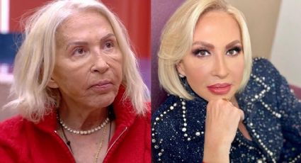 ¿Qué es la ritidectomía? La cirugía que se hará Laura Bozzo para estirarse la piel de la cara y cuello