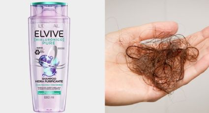 Shampoo morado: la razón por la que Elvive podría provocar la caída del cabello